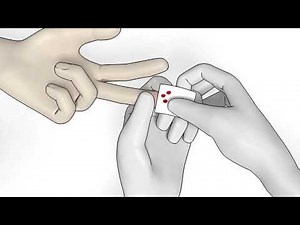 Hb 801 Hemoglobin Analyzer - How to Measure Hemoglobin