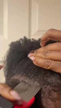 Watch me remove my dandruff #dandruffremoval #asmrscalpmassage #asmrscalpscratching ￼