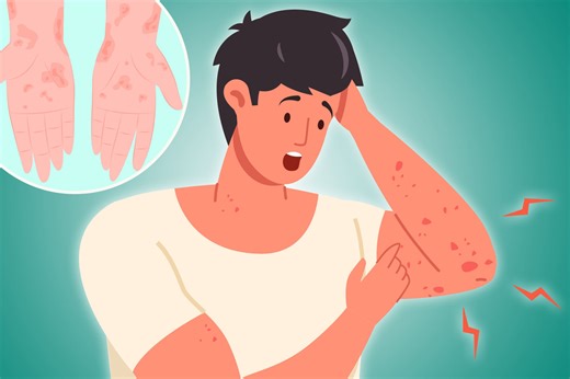 The 'intense' sign of condition you might notice at night and how to treat