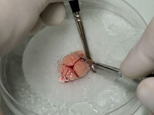 Whole-cell Patch-clamp Recordings from Morphologically- and Neurochemically-identified Hippocampal Interneurons