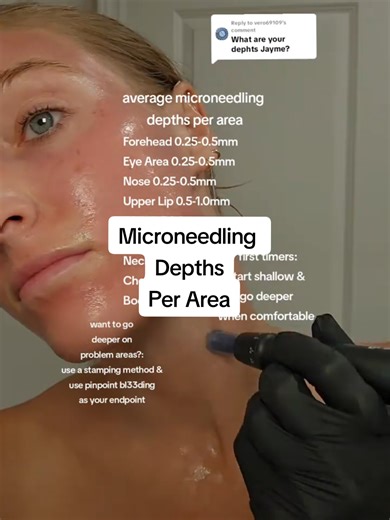 Microneedling Depths 🩷✨️💦 | micro needling