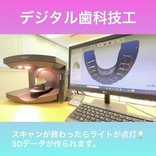 デジタル歯科技工｜口腔内模型をスキャン！ #Shorts #歯科技工 #3dcad