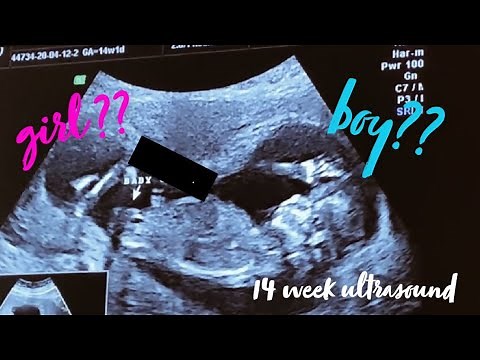 14 WEEK 3D ULTRASOUND GENDER REVEAL !