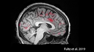 Slow oscillating neural activity during non-REM sleep triggers waves of cerebrospinal fluid that flow in and out of the sleeping brain, washing it of harmful metabolic waste products, researchers find in a new Science study. The new research reveals a key component in the neurophysiology of sleep: https://fcld.ly/uvwy8ib | Science