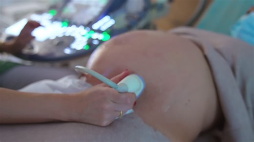 Modern ultrasound machine with multiple light buttons. Doctor quickly pressing the keys at apparatus while moves the device in other hand on pregnant belly. | Premium Stock Video Footage