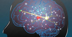 New MIT system wirelessly powers medical implants using radio waves