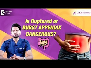 Appendix operation|Danger of Appendix rupture| Laparoscopic #appendicitis removal-Dr.Abhishek Katha