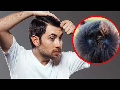 Como CONTROLAR los REMOLINOS de tu CABELLO y PEINARTE FACÍL - J.M. Montaño