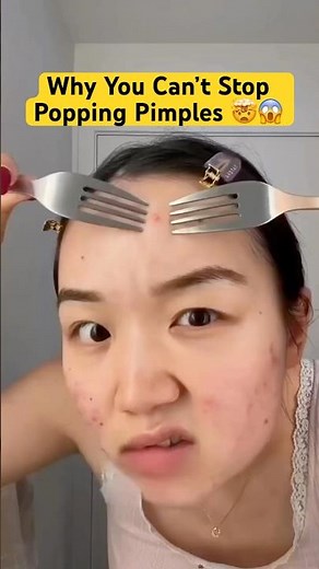 Why You Can’t Stop Popping Pimples 🤯😱