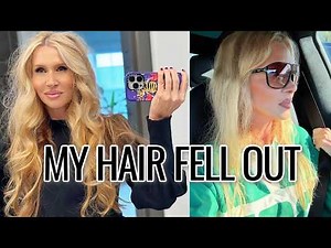 Female Hair Loss: Why My Hair Fell Out + What Helped 💔