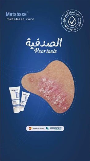 Metabase is designed for anyone who needs a real solution. - ميتابيز مصمم لكل من يحتاج لحل حقيقي.