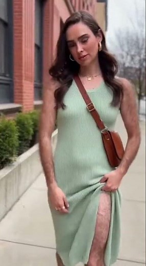 Hairy Grace That Challenges Every Standard