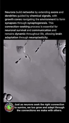 The Brain Forms Its Communication Network As Neurons Extend Axons And Dendrites To Find Connections