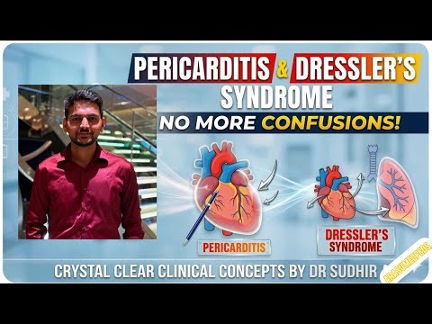 Pericarditis | Dressler Syndrome | Clinical Concpets by Dr Sudhir | Internal Medicine Basics
