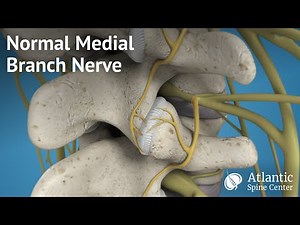 Normal Medial Branch Nerve