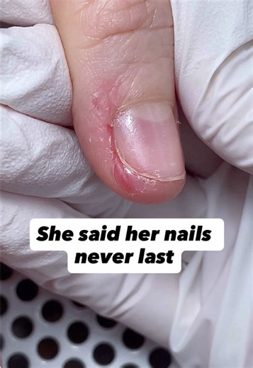 Nail Transformations: Client Success Stories Revealed