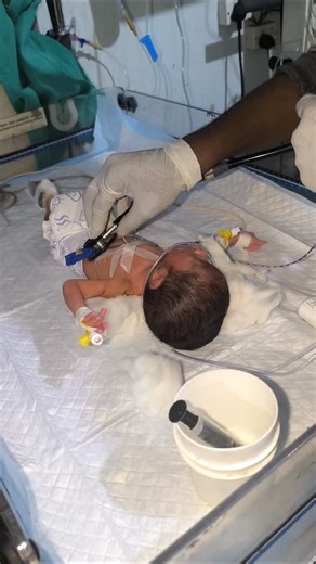 SUMIT NICU NURSING STM on Instagram: "Newborn baby feeding milk✨🍼👍 #youtubeshorts #nursing #medical #newbornbaby #beautiful feeding"