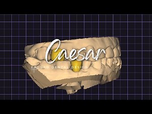 Exocad Tutorial: Molar & Premolar Tooth Design Step by Step!