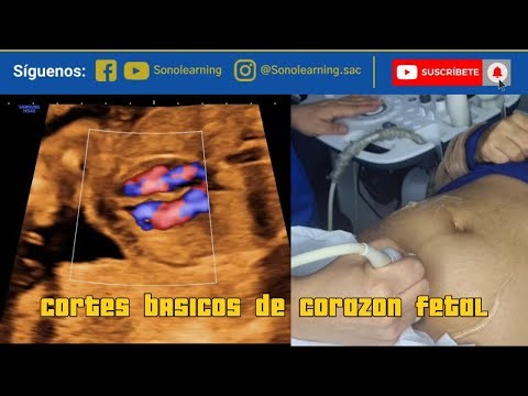 CORTES BASICOS DEL CORAZON FETAL #embarazo #ultrasound #learning #cursoonline #obstetrician #feto