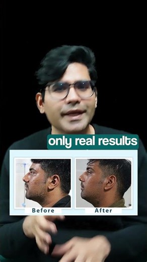 White beard problem?Get expert care & confidence back with advanced treatment at Dr. Awish Clinic,