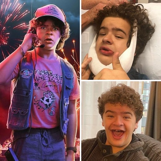Dustin, de Stranger Things, fue rechazado por su físico: tiene una rara enfermedad que deforma sus huesos y dientes. #strangerthings #strangerthingsfans #gatenmatarazzo #famosos #icons | Icons Español