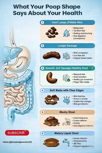 What Your Poop Shape Says About Your Health | S tool Types & Digestive Health Guide #guttalk #health