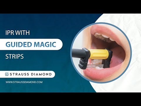 How to Perform IPR with Our New Guided Magic Strip System - Strauss Diamond