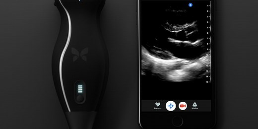 New "Ultrasound on a Chip" Tool Could Revolutionize Medical Imaging