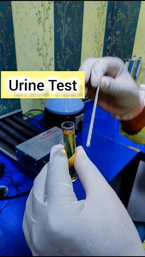 Urine Strip Test#youtubeshorts #viralvideo