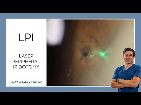 LPI (Laser Peripheral Iridotomy)