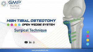 HIGH TIBIAL OSTEOTOMY OPEN WEDGE SYSTEM - SURGICAL TECHNIQUE | GMP Meditech