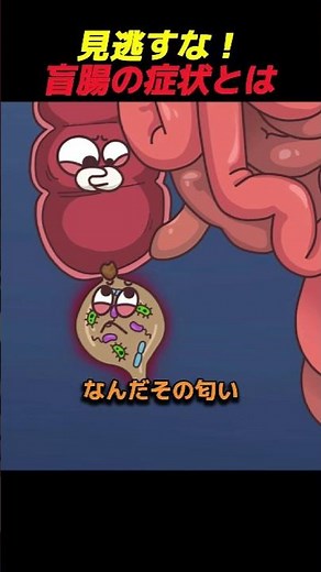 見逃すな！盲腸の症状とは