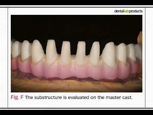 Bench Mastery: Using IPS e.max Press with a Zirconia Framework