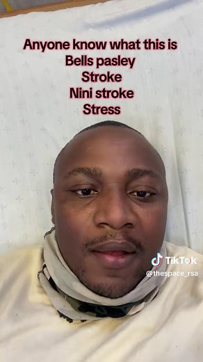 Understanding Bell's Palsy: Symptoms and Home Treatments