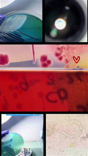 La microbiología no es solo tubos, placas y microscopios. Es paciencia, curiosidad y amor por lo invisible. Cuando amas tu profesión, todo fluye: las horas no pesan, el aprendizaje emociona y cada microorganismo te cuenta una historia. Hoy celebro el amor por lo que hago, porque en la microbiología también se ama… con ciencia, vocación y corazón. 🧫❤️ #microbio_lupa