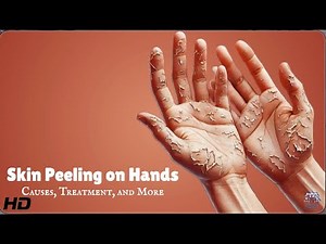 Skin Peeling Solutions: What Really Works?