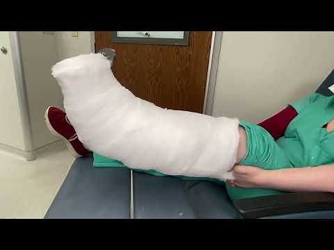 Robert Jones Splint For Calcaneus Fractures