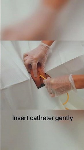 Inserting Catheter Procedure #nursing #gnmnursing #bscnursing #medicalstudent #medicalschool
