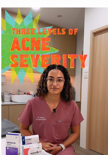 Understanding Acne Severity and Treatment Options
