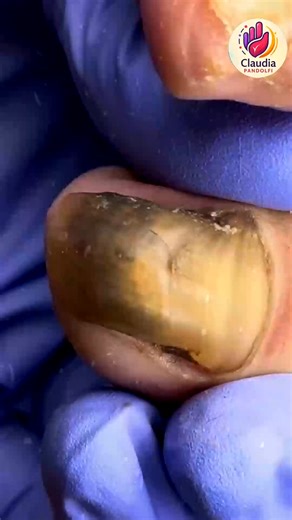 12K views · 119 reactions | Ep.1026 Winter mindful breaks for calorie awareness  #CalorieControl #HeartHealthyDiet #SeasonalWellness | Claudia Pandolfi | Facebook