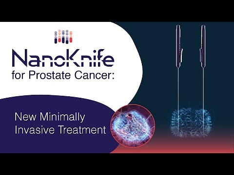 Nanoknife for Prostate Cancer: New Minimally Invasive Treatment