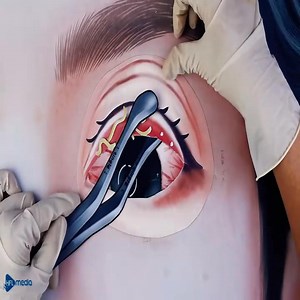 349.ASMR Remove Deep Cleaning Eyelash Extensions | ASMR Fun