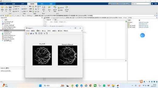 【图像分割】基于matlab数字形态学数字视网膜图像血管提取DRIVE数据集分割【含Matlab源码 10948期】