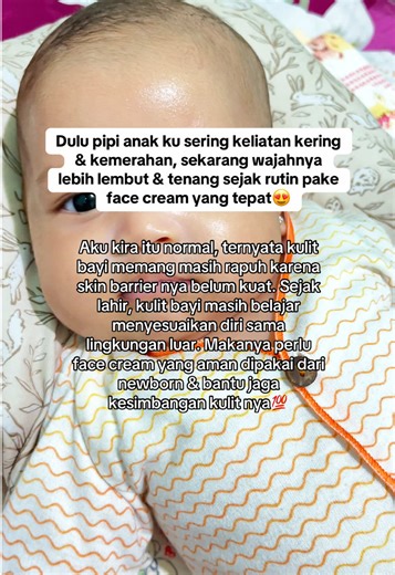 Pipi anak sering keliatan kering dan iritasi? Tenang moms skrg udah ada face cream yg bagus buat sikecil & udah DSA Approved loh😍 #moellfacecream #facecreamanak #facecreambayi #moellskincarebaby #skincareanak