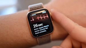 Apple Watch ECG feature debuts in Australia and Vietnam with watchOS 7.4 | AppleInsider