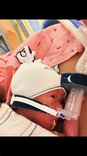 Sade Howard on Instagram: "This was Day 12 in the NICU. Last night with my Brave girl. It was late when I left, so I’m posting now. But Ms. Brave is 3lbs 3oz she is growing! Her eyes were wide open last night , she’s a night owl like her mama 🥰💕 we read bedtime stories, sang, prayed. She’s so sweet. Like truly. She’s so strong. She’s so Brave. She’s so loved. We continue to declare GROW BRAVE GROW over her. Every day I’m in awe. We’re seeing God answer prayers quickly on her behalf. Her belly 