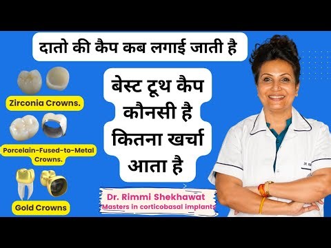 Dental Caps Cost | Tooth Cap Price, Types of Dental Cap in Hindi |