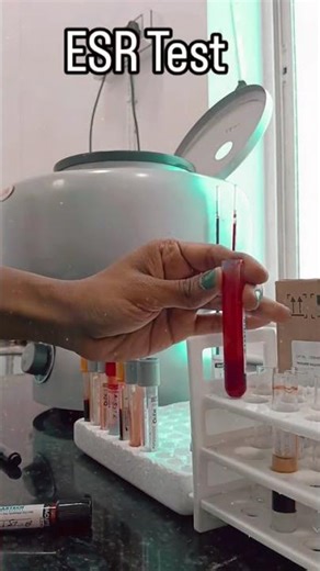 ESR test short process short vedio #labchannel #shortvideo #shortsyoutube