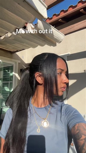 #ethnicrhinoplasty #rhinoplasty #nosejob #nosejobturkey | nose