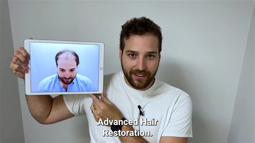 *#1 Hair Loss Solution in Oklahoma* Hair restoration changes lives. We helped 40,000 patients get their hair and confidence back. Why Advanced Hair? ✅ Simple 1-day procedure ✅ Uses your real hair ✅ Permanent results Book a free consultation with Advanced Hair today! | Advanced Hair Restoration